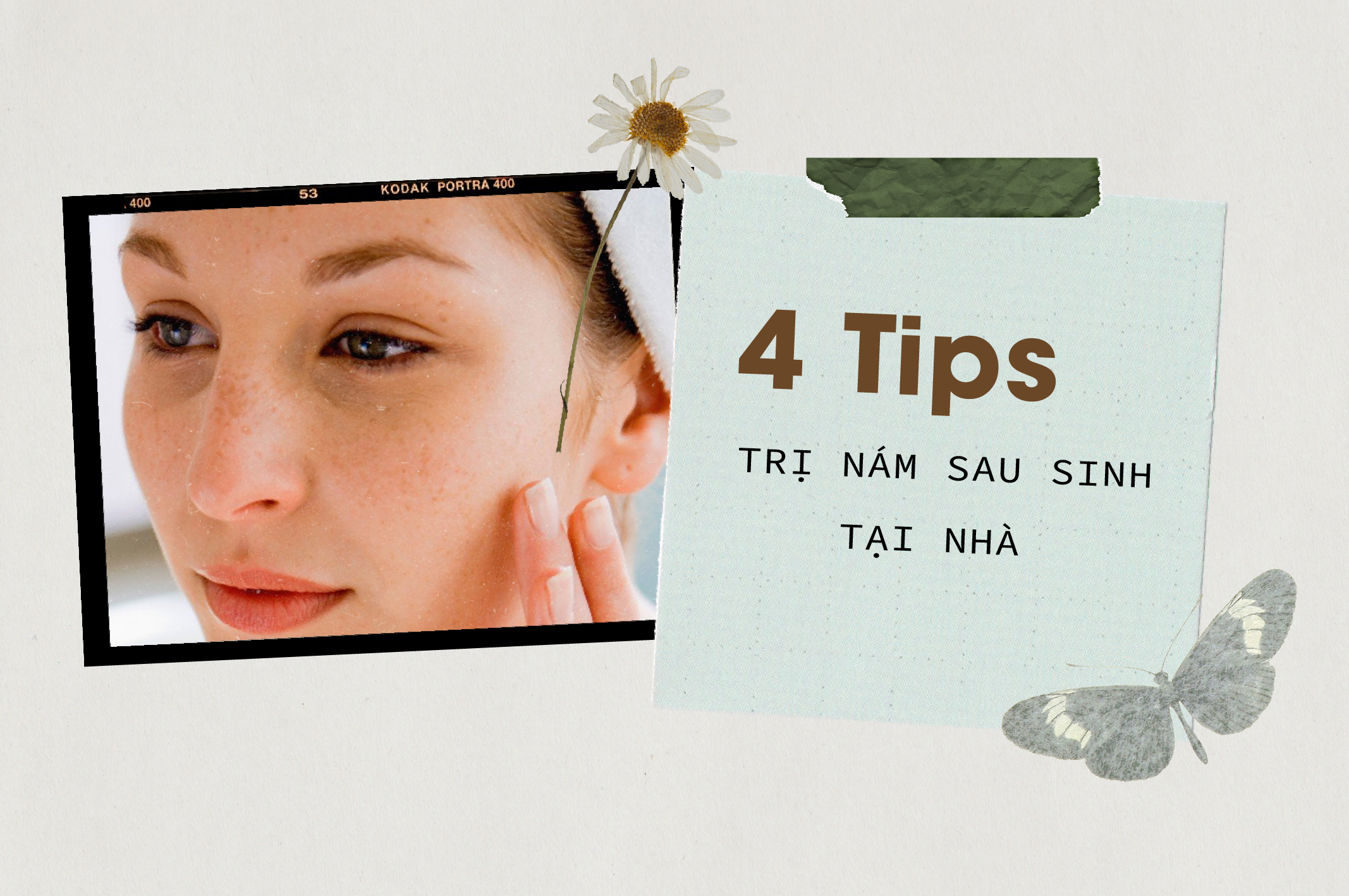 4-tips-tri-nam-sau-sinh-tai-nha