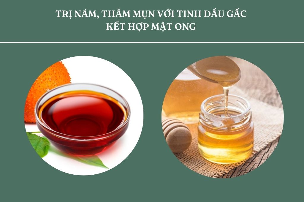 tri-nam-tham-mun-voi-tinh-dau-gac-ket-hop-mat-ong