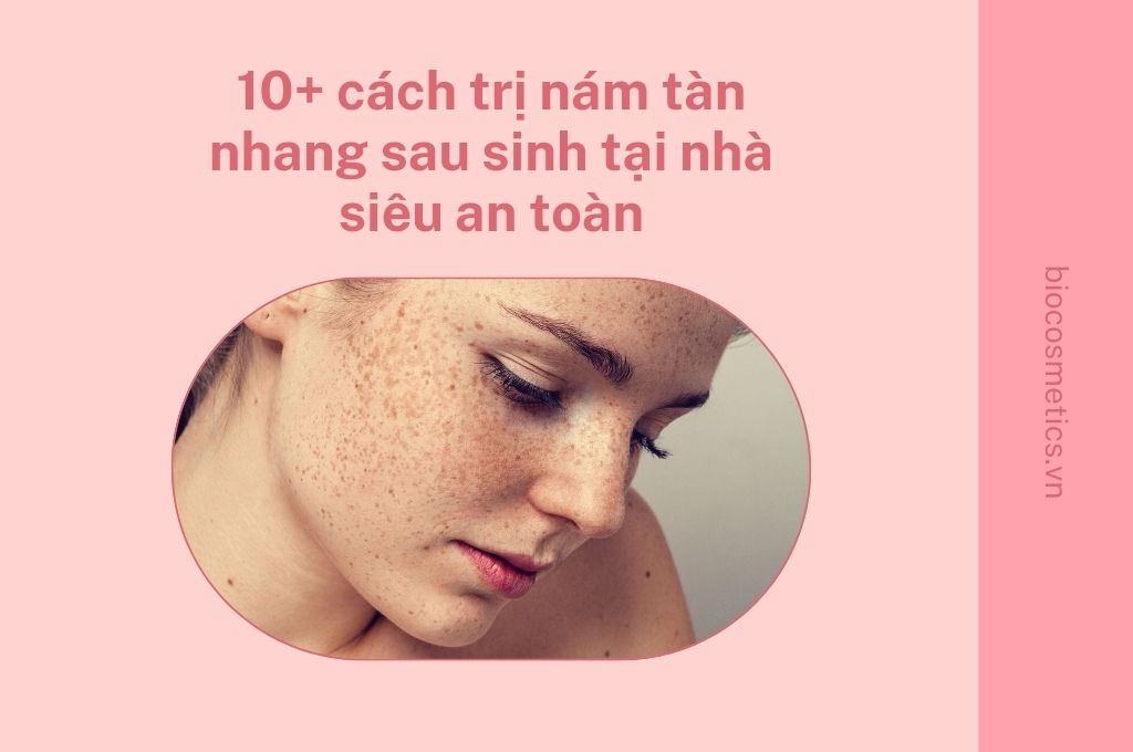 10-cach-tri-nam-tan-nhang-sau-sinh-tai-nha-sieu-an-toan