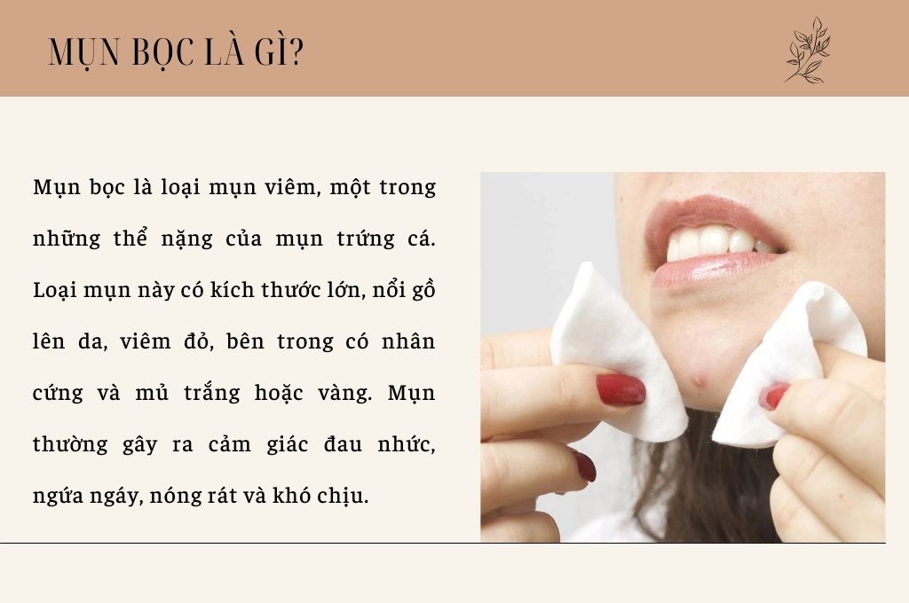 mun-boc-la-gi