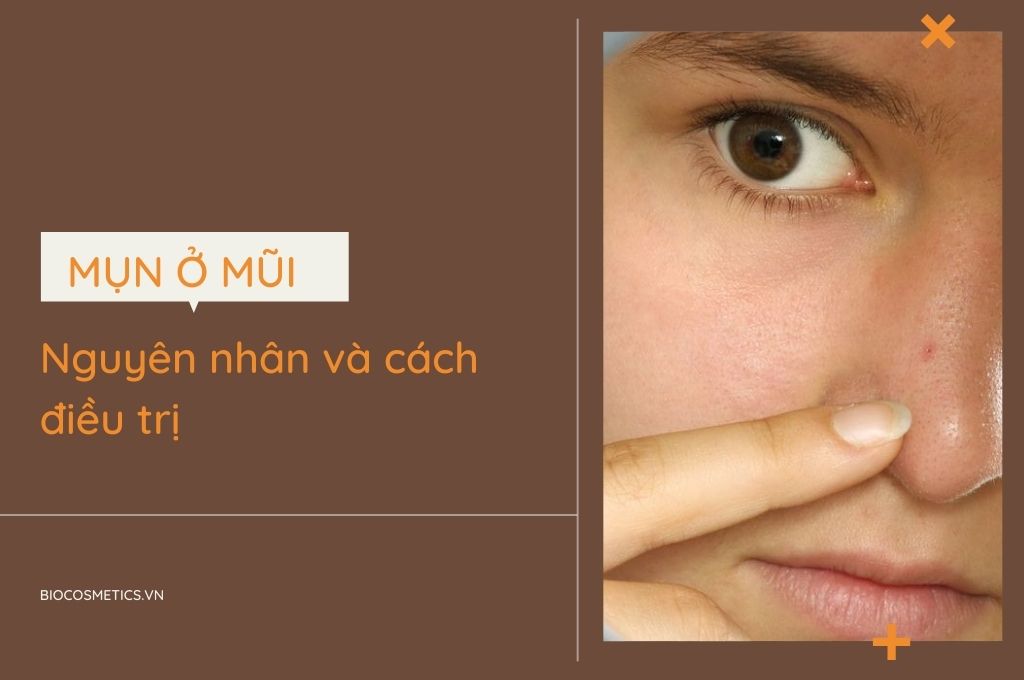 mun-o-mui-nguyen-nhan-va-cach-dieu-tri